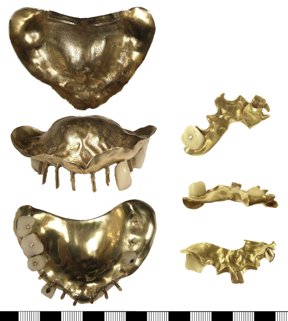 Porcelain teeth on gold dental plates (LANCUM-3DE363 and IOW-D164D2)